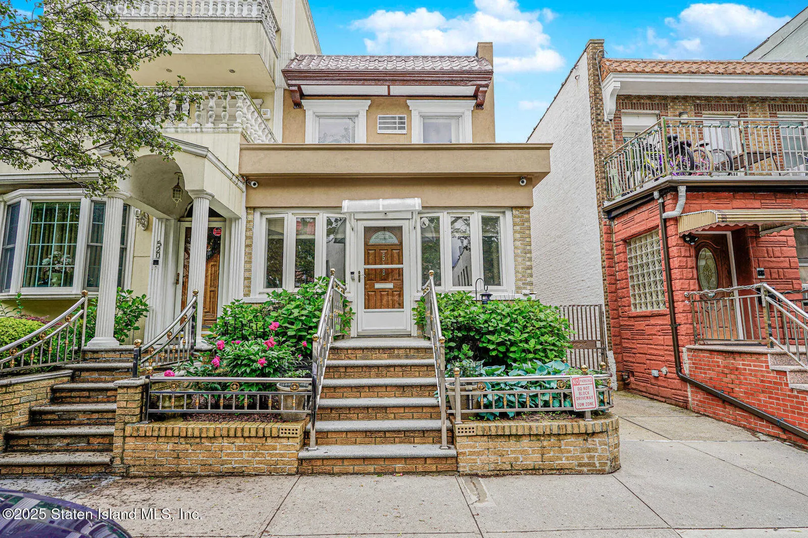 518 78th Street photo 2